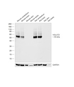 VGLUT2 Antibody in Western Blot (WB)