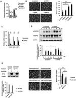 Epsin 2 Antibody in Western Blot (WB)