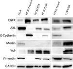 NF2 Antibody in Western Blot (WB)
