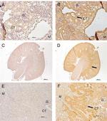 ADAMTS4 Antibody in Immunohistochemistry (IHC)