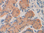 ISLR Antibody in Immunohistochemistry (Paraffin) (IHC (P))