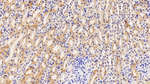 DVL1 Antibody in Immunohistochemistry (Paraffin) (IHC (P))