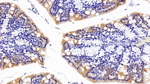 DVL1 Antibody in Immunohistochemistry (Paraffin) (IHC (P))