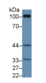 TBXA2R Antibody in Western Blot (WB)