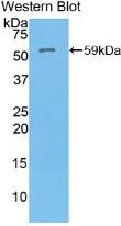 ATP4A Antibody in Western Blot (WB)