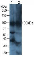 ATP4A Antibody in Western Blot (WB)