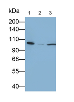 ADAM8 Antibody in Western Blot (WB)