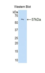PI16 Antibody in Western Blot (WB)