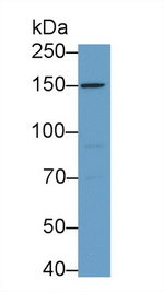 CD11d Antibody in Western Blot (WB)