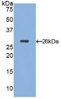 CD11d Antibody in Western Blot (WB)