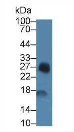 SAA Antibody in Western Blot (WB)