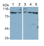 CD31 Antibody in Western Blot (WB)