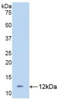 CD31 Antibody in Western Blot (WB)