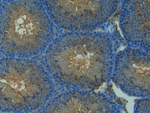 iNOS Antibody in Immunohistochemistry (Paraffin) (IHC (P))