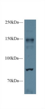 iNOS Antibody in Western Blot (WB)