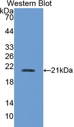 iNOS Antibody in Western Blot (WB)