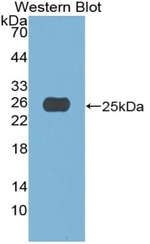 A1CF Antibody in Western Blot (WB)