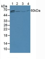 A1CF Antibody in Western Blot (WB)