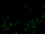 SMN1 Polyclonal Antibody
