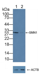 SMN1 Antibody in Western Blot (WB)