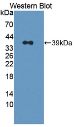 SMN1 Antibody in Western Blot (WB)