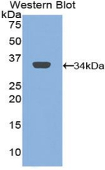 CD206 Antibody in Western Blot (WB)