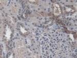 RAB37 Polyclonal Antibody