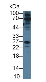 RAB37 Antibody in Western Blot (WB)