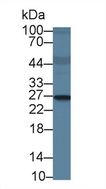 RAB37 Antibody in Western Blot (WB)