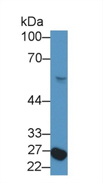 NFIX Antibody in Western Blot (WB)
