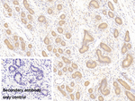 PTPRM Polyclonal Antibody