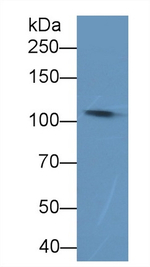 Complement C5a Antibody in Western Blot (WB)