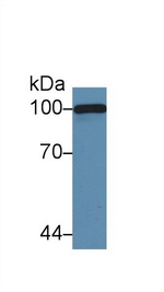 Complement C5a Antibody in Western Blot (WB)