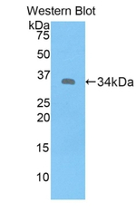 MT1E Polyclonal Antibody