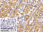 LAMP1 Antibody in Immunohistochemistry (Paraffin) (IHC (P))