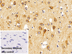 LAMP1 Antibody in Immunohistochemistry (Paraffin) (IHC (P))
