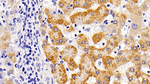 LAMP1 Antibody in Immunohistochemistry (Paraffin) (IHC (P))