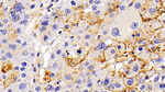 LAMP1 Antibody in Immunohistochemistry (Paraffin) (IHC (P))