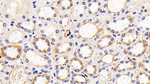 LAMP1 Antibody in Immunohistochemistry (Paraffin) (IHC (P))