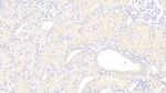 LPA Antibody in Immunohistochemistry (Paraffin) (IHC (P))
