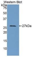 LOXL3 Antibody in Western Blot (WB)