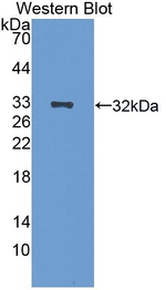 EGR2 Antibody in Western Blot (WB)