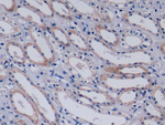COL4A3 Antibody in Immunohistochemistry (Paraffin) (IHC (P))