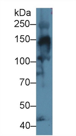 COL4A3 Antibody in Western Blot (WB)
