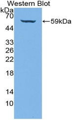 COL4A3 Antibody in Western Blot (WB)