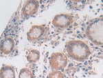 UTRN Antibody in Immunohistochemistry (Paraffin) (IHC (P))