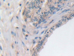 UTRN Antibody in Immunohistochemistry (Paraffin) (IHC (P))