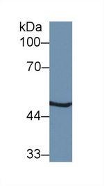 PSMC2 Antibody in Western Blot (WB)