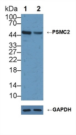 PSMC2 Polyclonal Antibody
