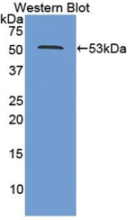 PSMC2 Antibody in Western Blot (WB)